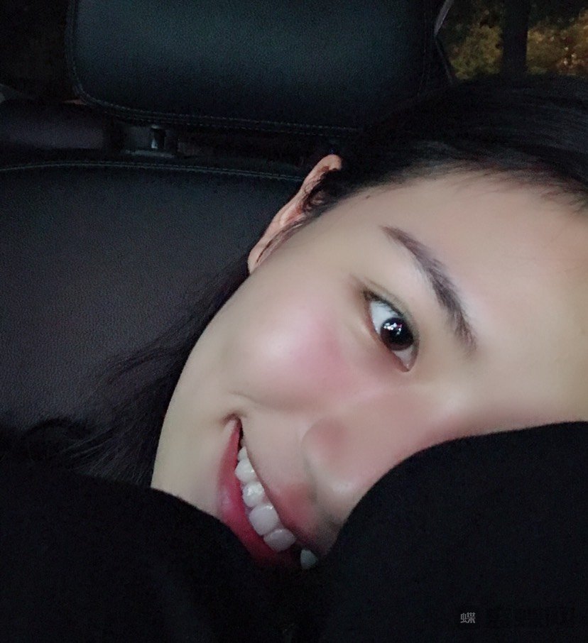 成都大华医学美容医院双眼皮价格多少钱？
