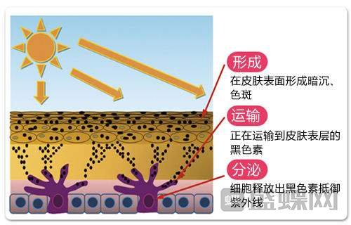 什么是像素激光？像素激光针对哪种皮肤？