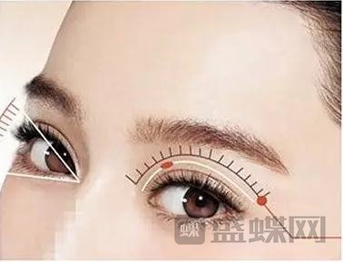 想做双眼皮手术，知道这几点很重要