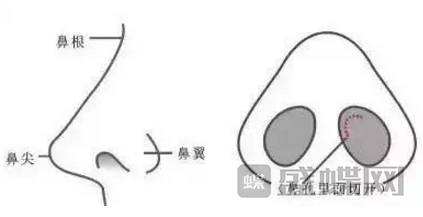 隆鼻术前术后【准备事项明细】