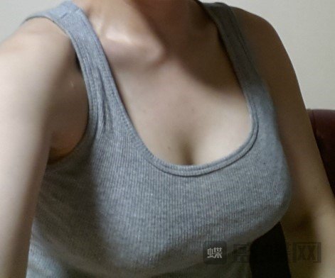假体隆胸手术材料怎么选择？