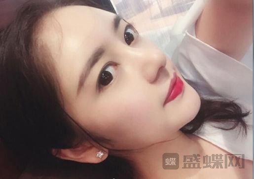 硅胶和膨体到底哪个好？科普分享