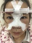 我做了，术前术后简直是两个人