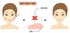 上海九院打让脸变的更漂亮