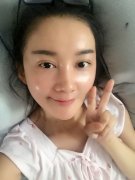 <b>北京鹏爱医疗美容医院丰额头的价格是多少？</b>