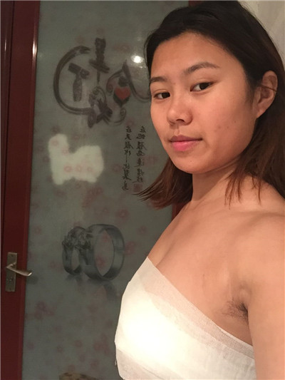 上海仁爱,杨苓山,隆胸,分享,