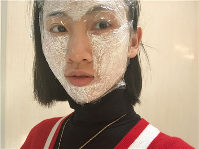 北京伟力嘉美信,叶文珏,埋线提升案例,价格,
