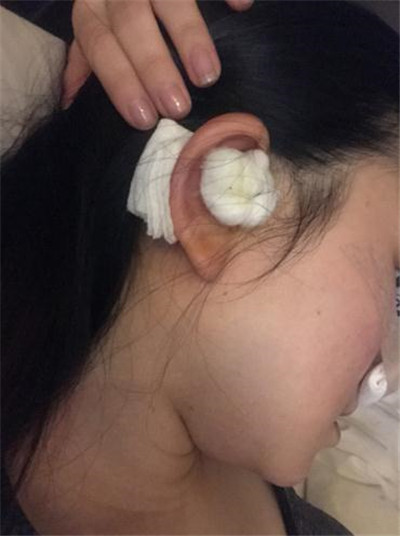 上海九院,张盈帆,,案例,价格,