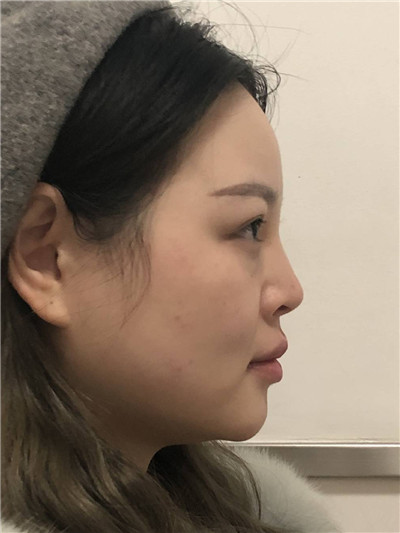 上海九院,陈付国,,案例,价格,