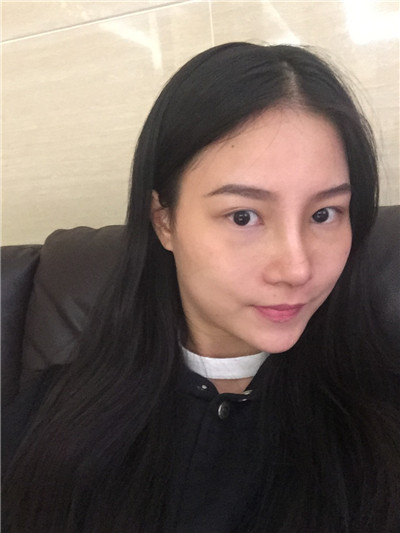 北京柏丽,李劲良,,脂肪填充,案例,价格,