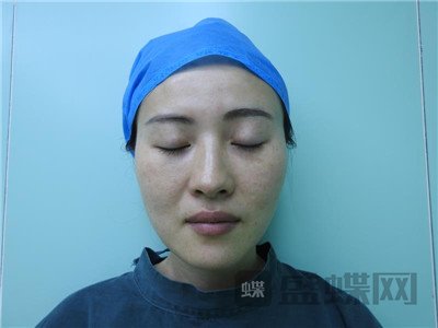 北京百达丽,苏婷,,案例,价格,