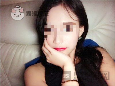 哈尔滨美联致美,侯锋玉,面部填充,案例,价格,