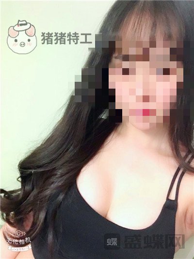 重庆五洲,魏恒,隆胸,案例,价格,