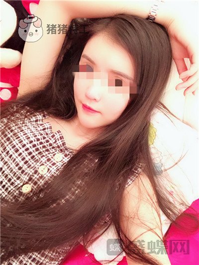 上海华美,李健,面部填充,案例,价格,