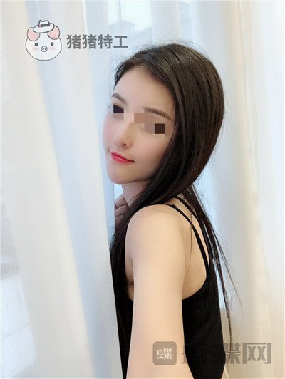 上海华美,李健,面部填充,案例,价格,