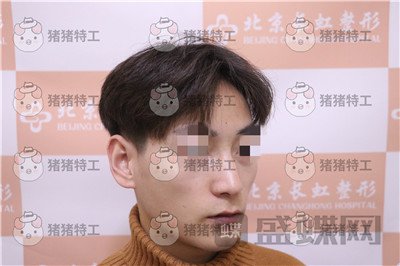 北京长虹,于志宏,,案例,价格,