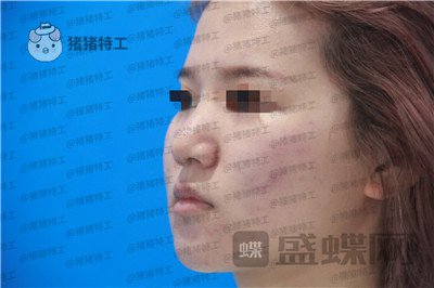 西安医学院,陈杰,,案例,价格,