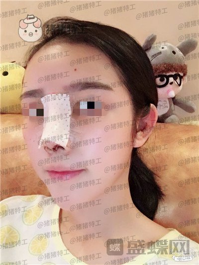 重庆铂生,杜亚旭,,案例,价格,
