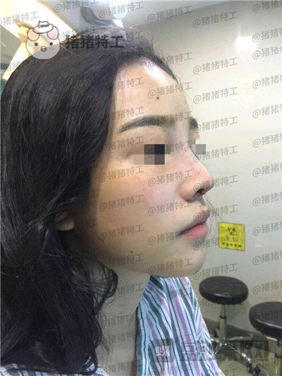 重庆铂生,杜亚旭,,案例,价格,