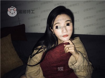 上海华美,李志海,下颌角整形,案例,价格,