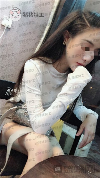上海华美,李志海,下颌角整形,案例,价格,