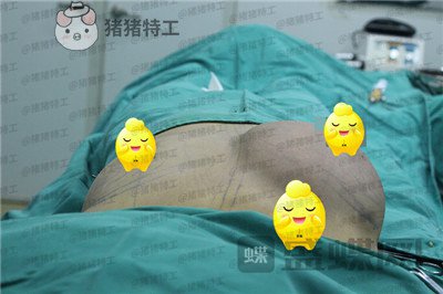 北京,京韩,王沛森,隆胸,案例,价格,