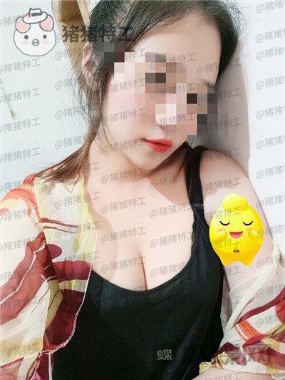 北京,京韩,王沛森,隆胸,案例,价格,