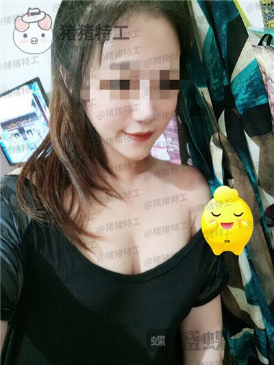 北京,京韩,王沛森,隆胸,案例,价格,