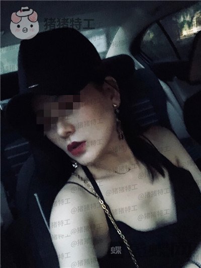 上海九院,张盈帆,下颌角整形,案例,价格,
