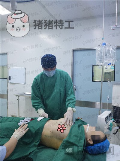 南京美贝尔,黄名斗,隆胸,案例,价格,