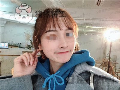 重庆铂生,杜亚旭,隆鼻,案例,价格,