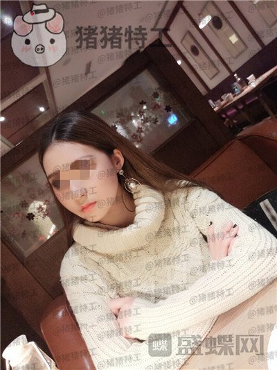 重庆华美,潘宝华,颧骨整形,案例,价格,