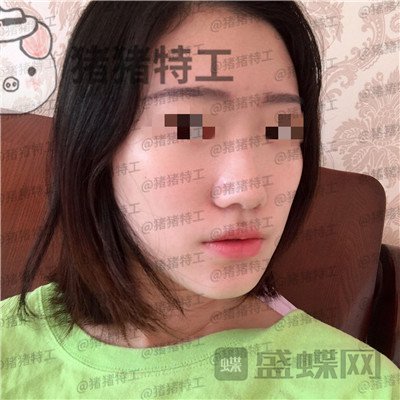武汉华美,马行,,案例,价格,
