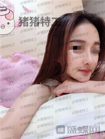 福州爱美尔,张胜利,,案例,价格,