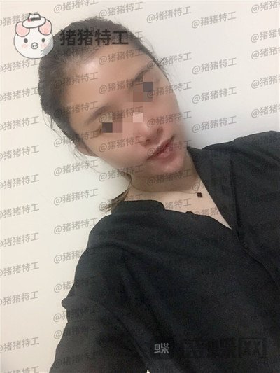天津南开区奥薇和谐,丛相文,面部填充,案例,价格,