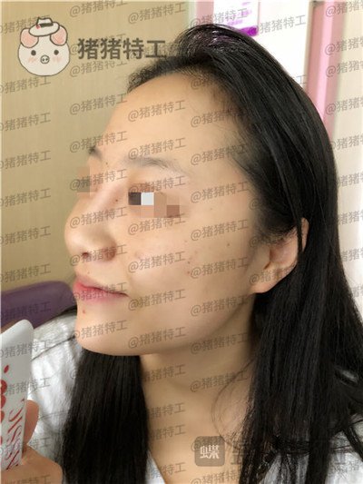 云南华美美莱,洪晓娅,,案例,价格,
