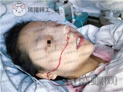 云南华美美莱,洪晓娅,,案例,价格,