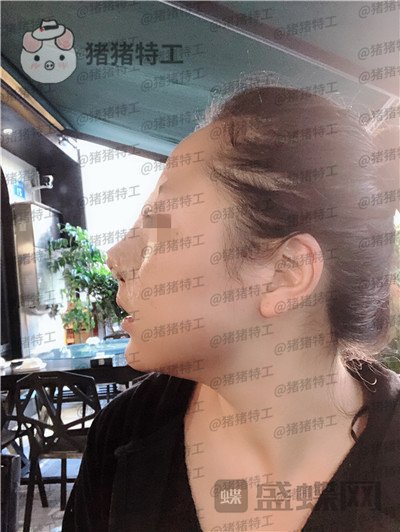云南华美美莱,洪晓娅,,案例,价格,