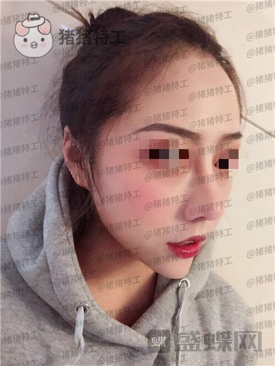 云南华美美莱,洪晓娅,,案例,价格,