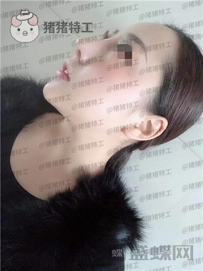 云南华美美莱,洪晓娅,,案例,价格,