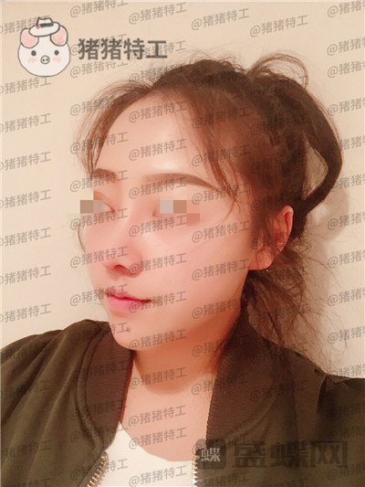 云南华美美莱,洪晓娅,,案例,价格,