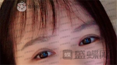 武汉中爱铭医,祁向峰,,案例,价格,