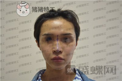 成都西区医院,车红昌,,案例,价格,