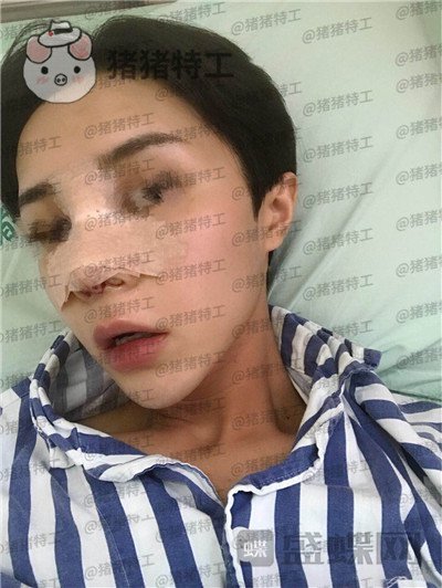 成都西区医院,车红昌,,案例,价格,