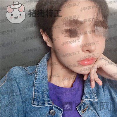 成都西区医院,车红昌,,案例,价格,