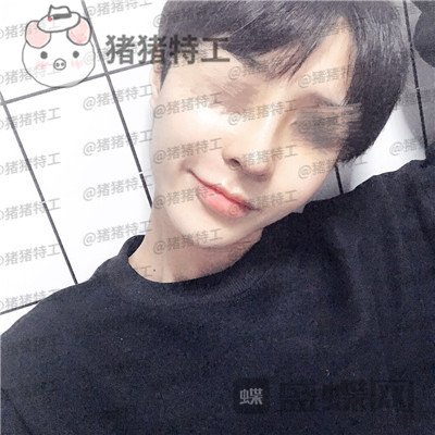成都西区医院,车红昌,,案例,价格,