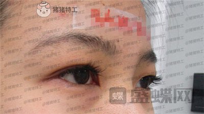 成都素美,杨迪,,案例,价格,