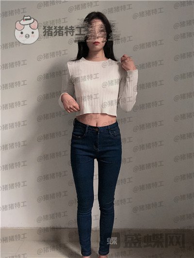 上海愉悦美联臣,荣峥,吸脂,案例,价格,