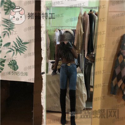 上海愉悦美联臣,荣峥,吸脂,案例,价格,