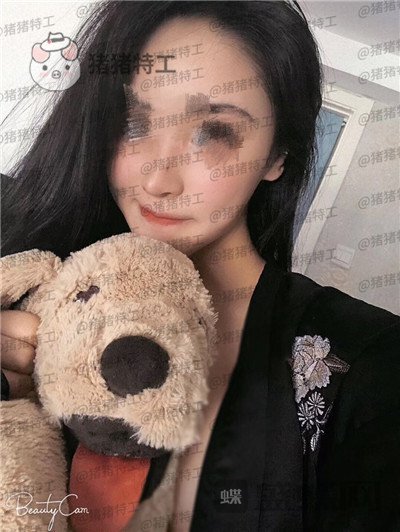 北京壹加壹,张绿峰,面部填充,案例,价格,
